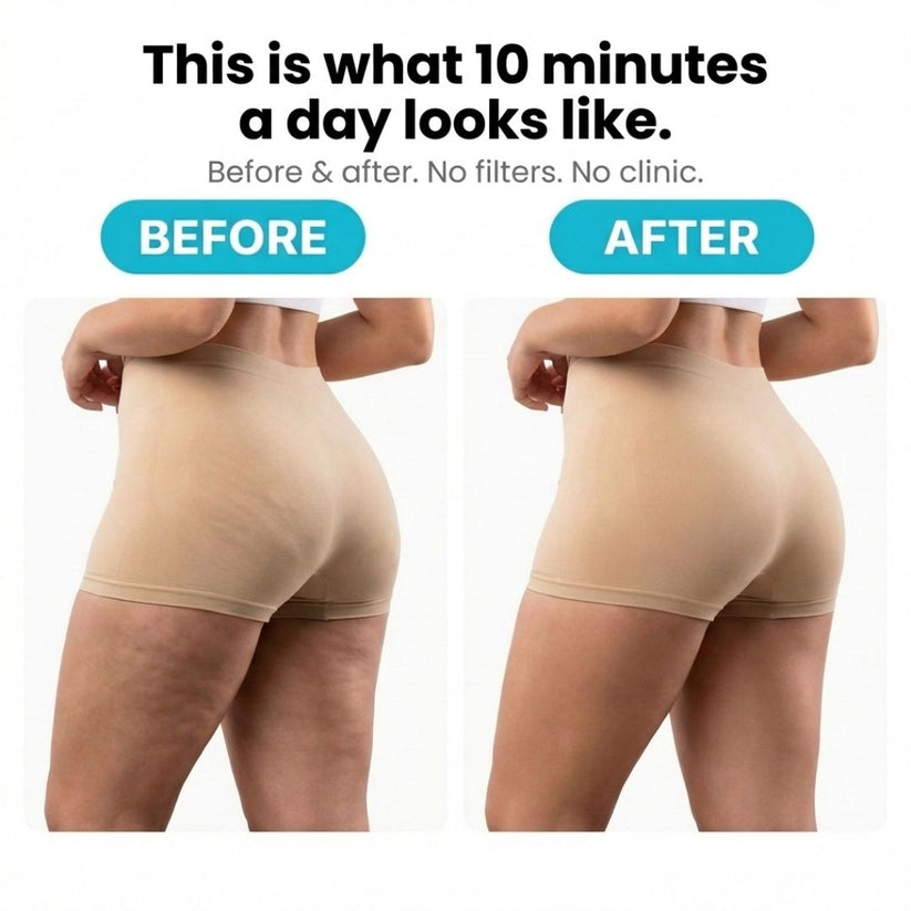Anti-Cellulite Rotating Massager
