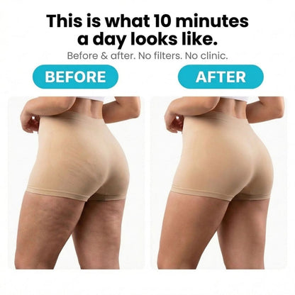 Anti-Cellulite Rotating Massager